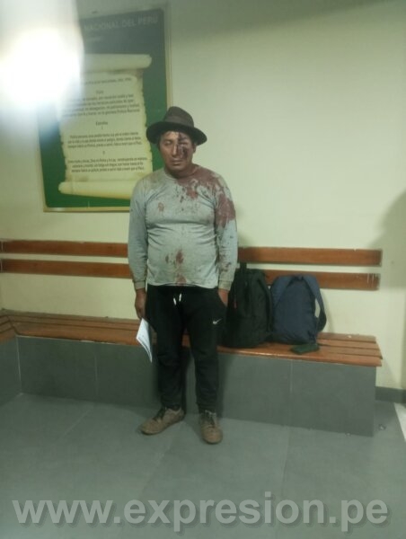 INVESTIGAN AGRESIÓN EN TORAYA 1