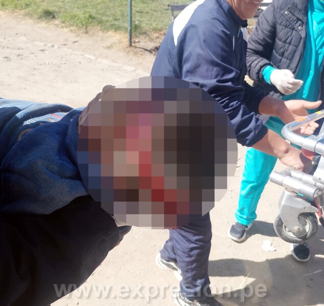 MENOR DE 4 AÑOS RESULTA HERIDO